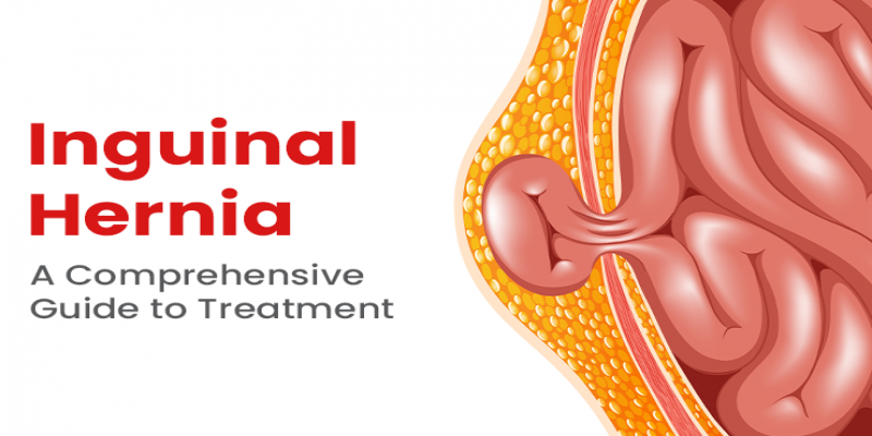 Cost and Insurance Considerations in Hernia Treatment